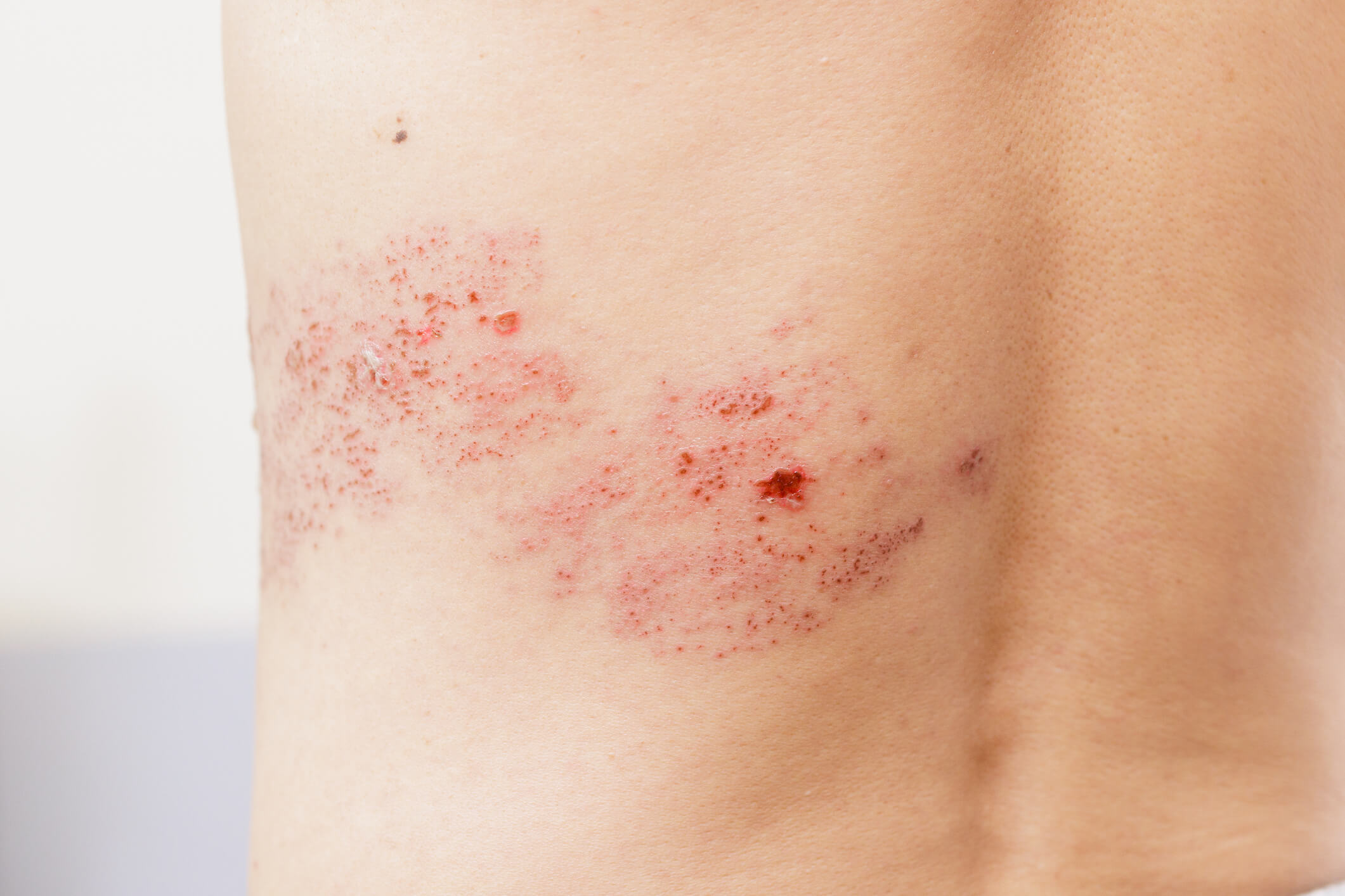 How Can ProAntro® Help Protect Your Liver?